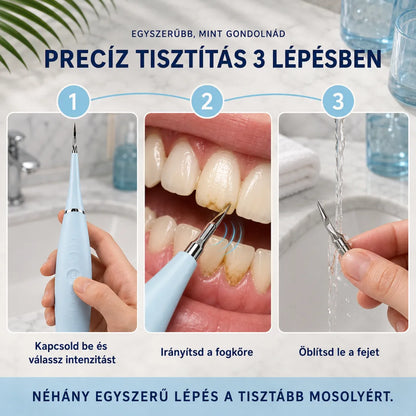 Precíziós Fogtisztító Készülék